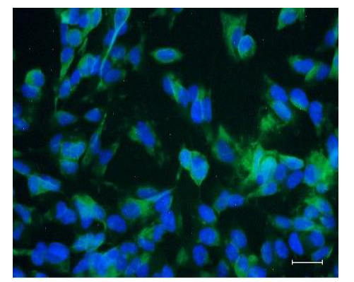 upm-biomedicals-note13-fig1.PNG