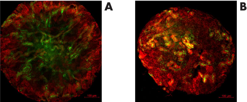 icc-staining-of-renal-organoids-gdx38-application-note.jpg