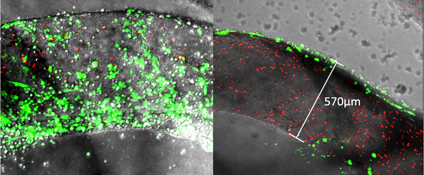 upm-biomedicals-note17-fig2.png