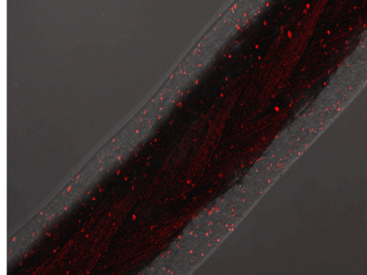 upm-biomedicals-note17-fig3.png