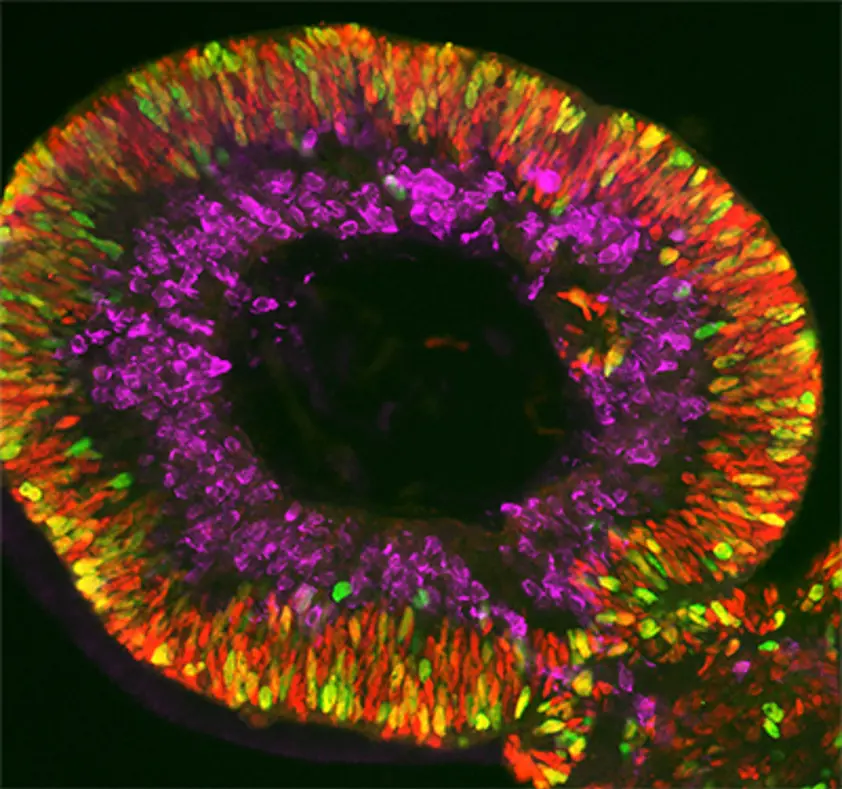 Million-dollar prize competition for 3-D retina organoids Million-dollar prize competition for 3-D retina organoids