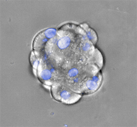 renal-carcinoma-cells.jpg